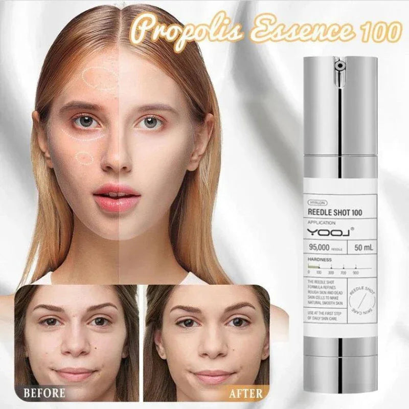 REEDLE SHOT 100 Essence packaging showing skin transformation results