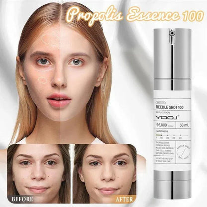 REEDLE SHOT 100 Essence packaging showing skin transformation results