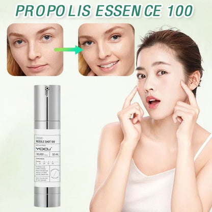 REEDLE SHOT 100 Essence before and after results - anti-aging face serum application